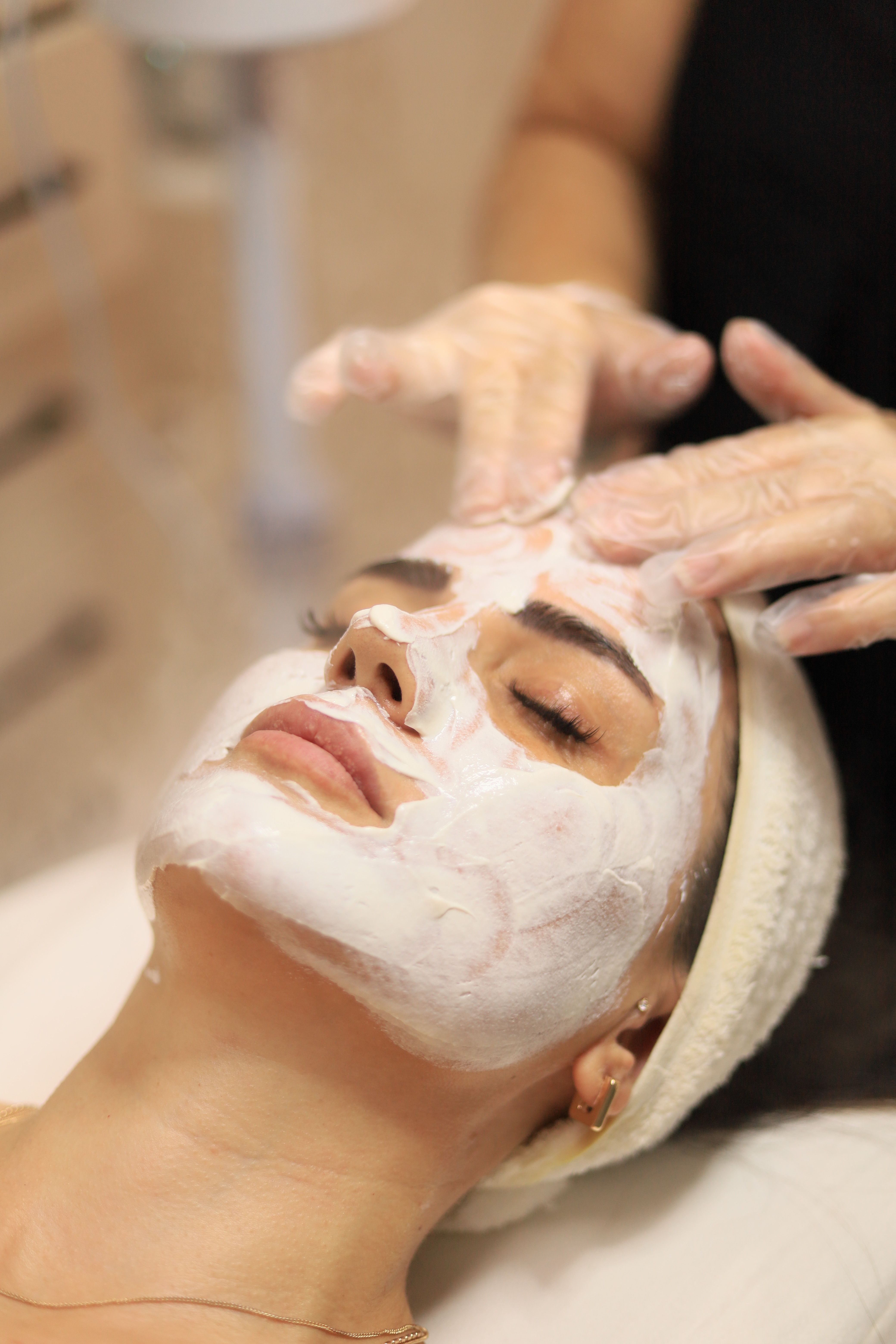 Limpieza facial profunda para piel con acné en Seishun Estética Bogotá